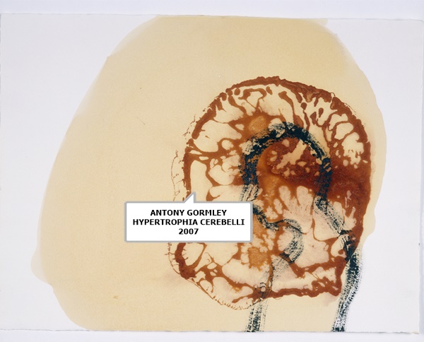 ANTONY GORMLEY 
HYPERTROPHIA CEREBELLI
2007